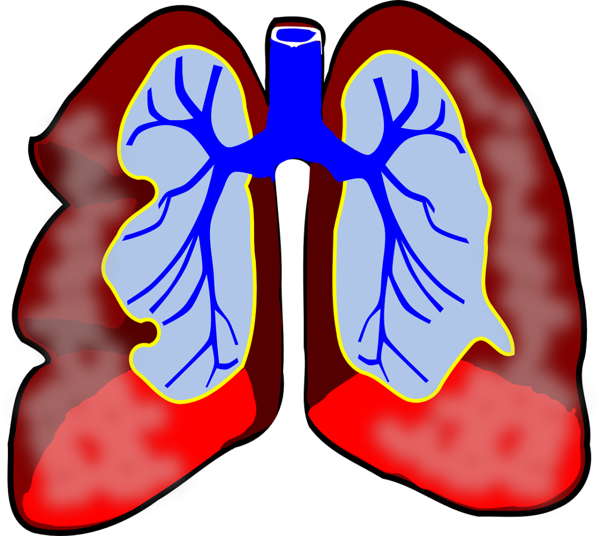 Querschnitt einer Lunge